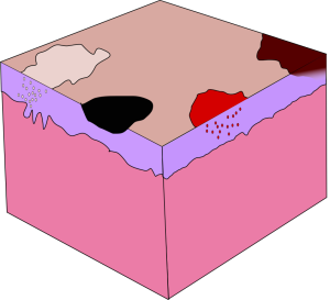 dermatologia